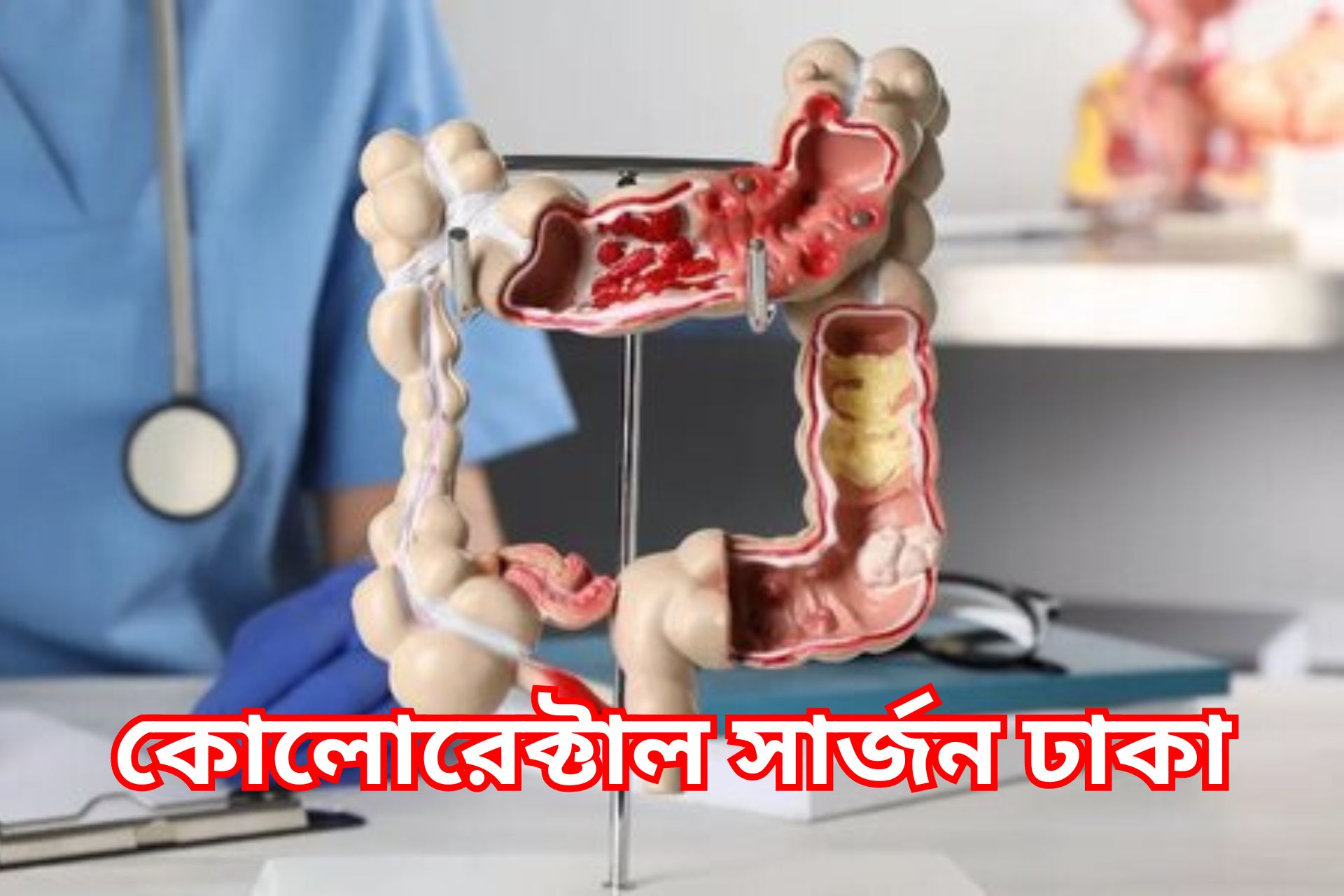 কোলোরেক্টাল সার্জন ঢাকা।